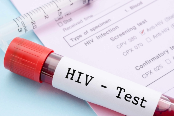 Anambra records 3,138 new HIV cases in 10 months