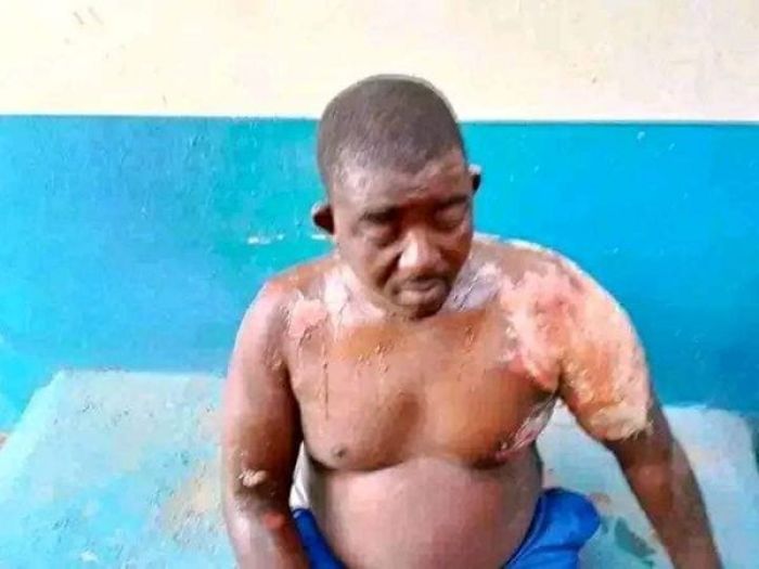 Newly wedded wife bathes her husband with hot water over frequent phone calls with other men