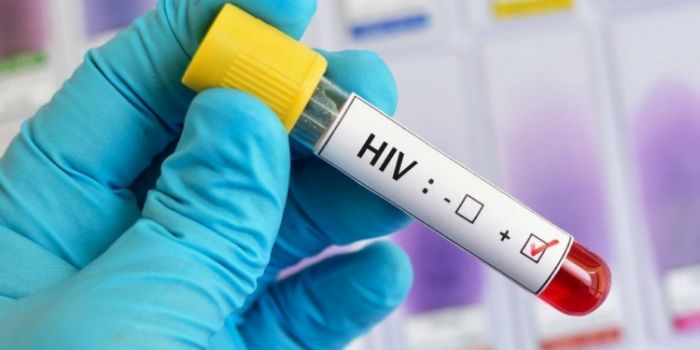 Herbal HIV treatment kills four in Gombe
